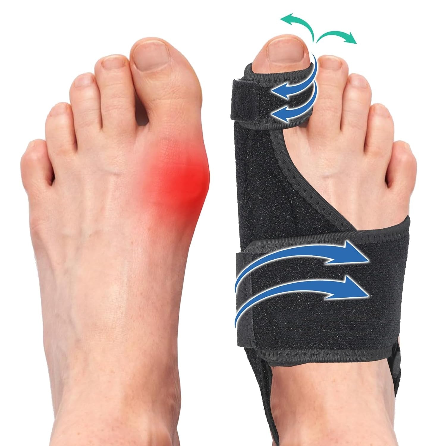 Neoprene Adjustable Bunion Toe Corrector