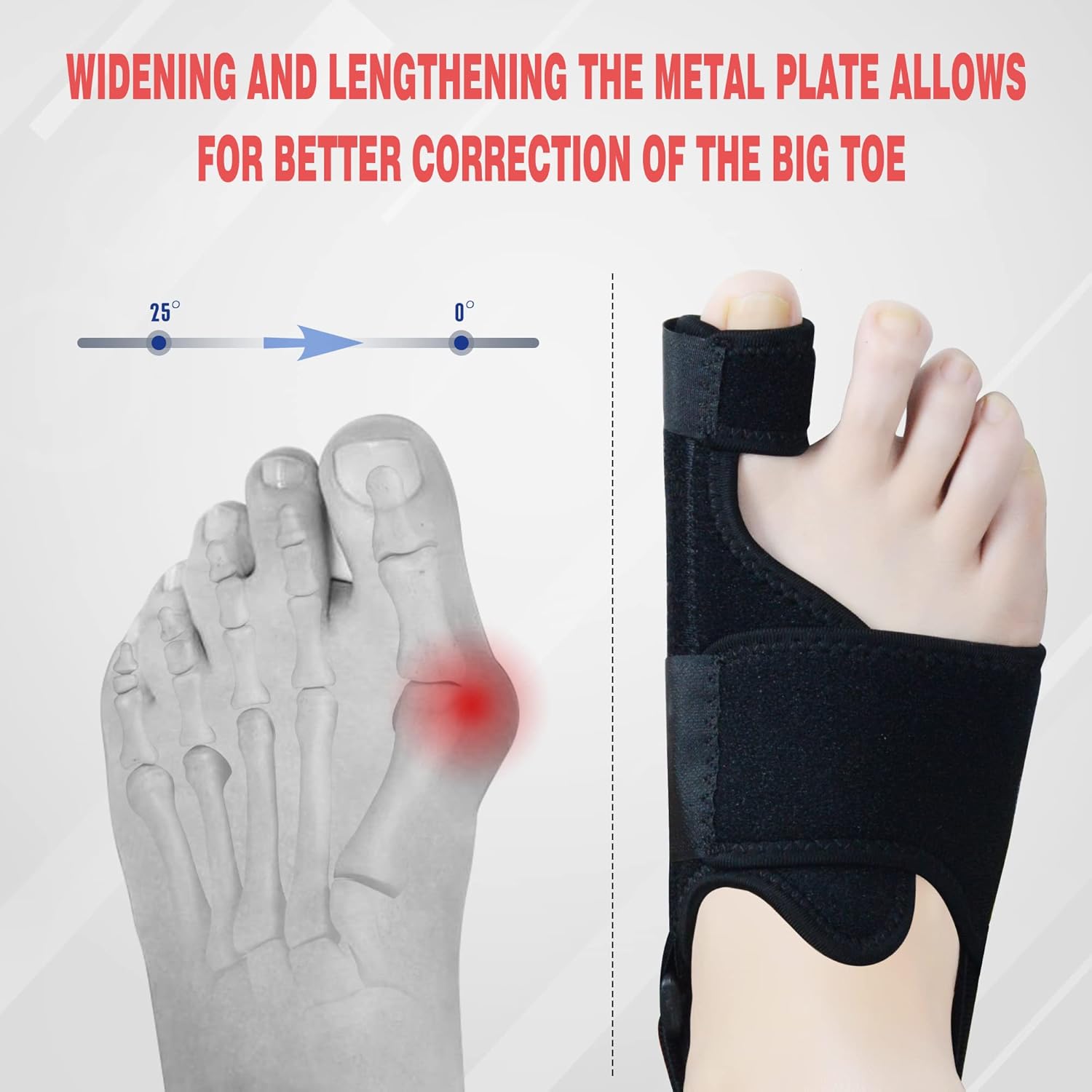 Neoprene Adjustable Bunion Toe Corrector