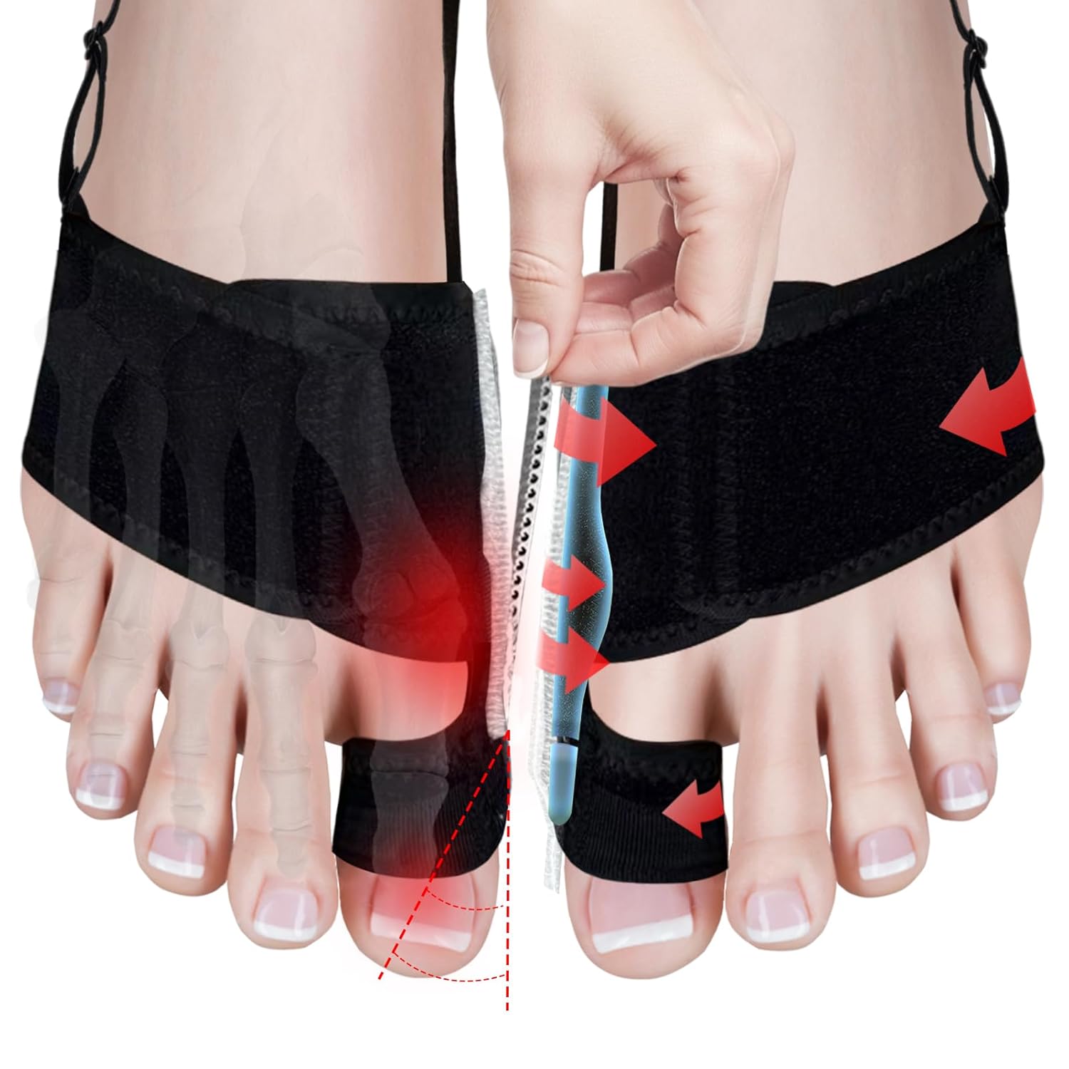 Neoprene Adjustable Bunion Toe Corrector